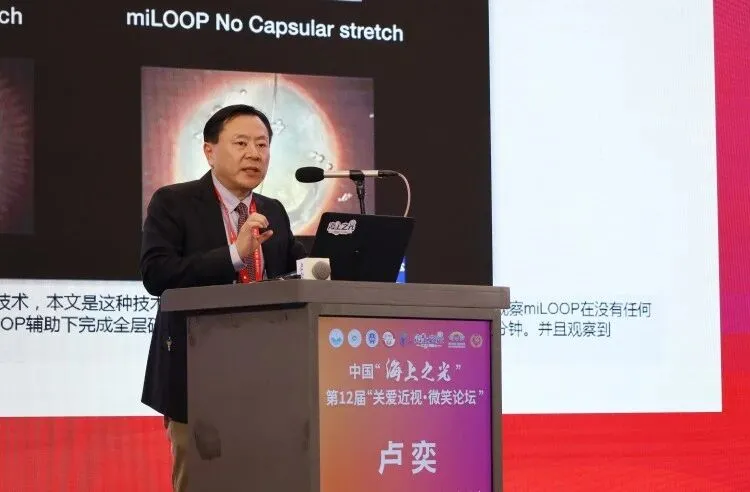 卢奕副总院长学术分享《MiLOOP在高度近视硬核白内障中的应用》